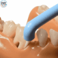 superslim tuft interspace brush to clean between teeth