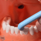 angle of the superslim tuft interspace brush in use