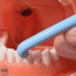 angle of the superslim tuft interspace brush in use