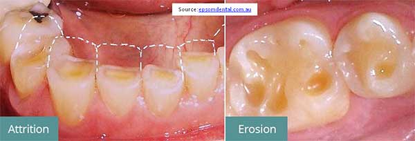 image showing erosion