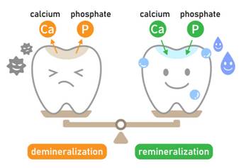 Demineralisation