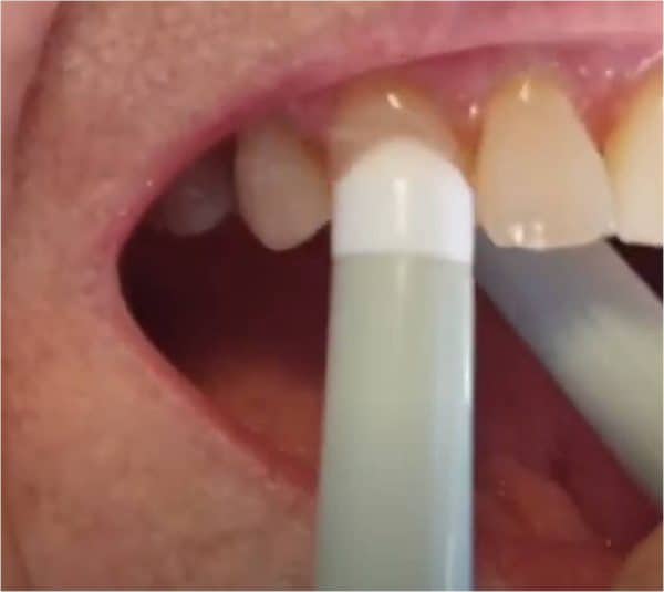 GumChucks - The Easier Way to Floss - Image 7