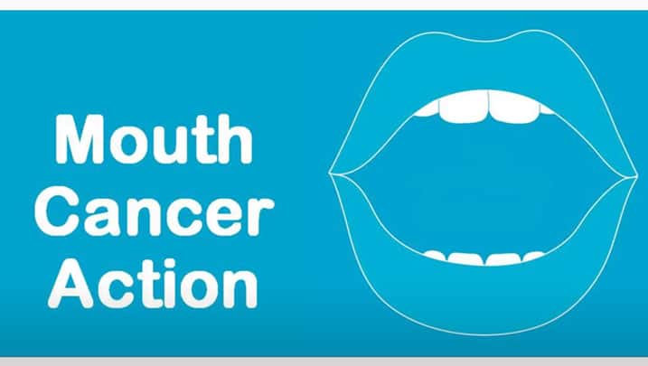Mouth and Oral Cancer