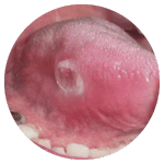 picture showing mouth cancer