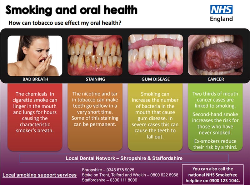Posting showing information about smoking and oral health