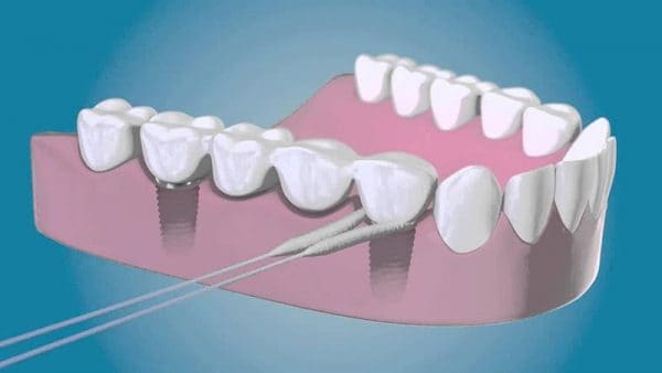 Oral B Superfloss