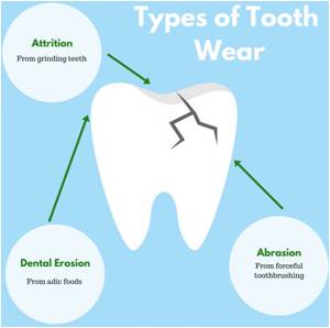 not decay tooth surface loss