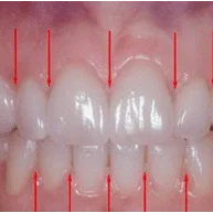 Growing Smiles
