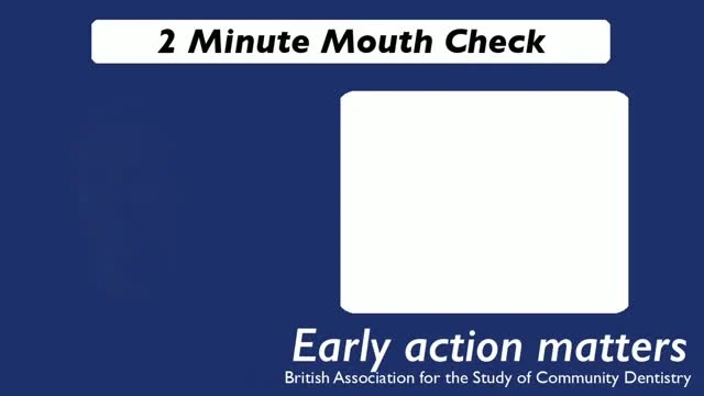 It's Check Up Tuesday. The day in the month we remind you to check your mouth for signs of mouth cancer.  This is the first in a series of videos produced by the British Association for the Study of Community Dentistry (BASCD) to raise awareness of mouth cancer. They are keen to hear your feedback so please let us know what you think.   #BASCD used AI to produce this video but the information spoken is evidence based (Delivering Better Oral Health)  Learn more about mouth cancer at https://growingsmiles.co.uk/healthy-tips-for-happy-teeth-and-oral-health/mouth-cancer-2/   #CheckUpTuesday #Mouthcancerawareness #Knowyourrisk #OralCancerAwareness CheckYourMouth