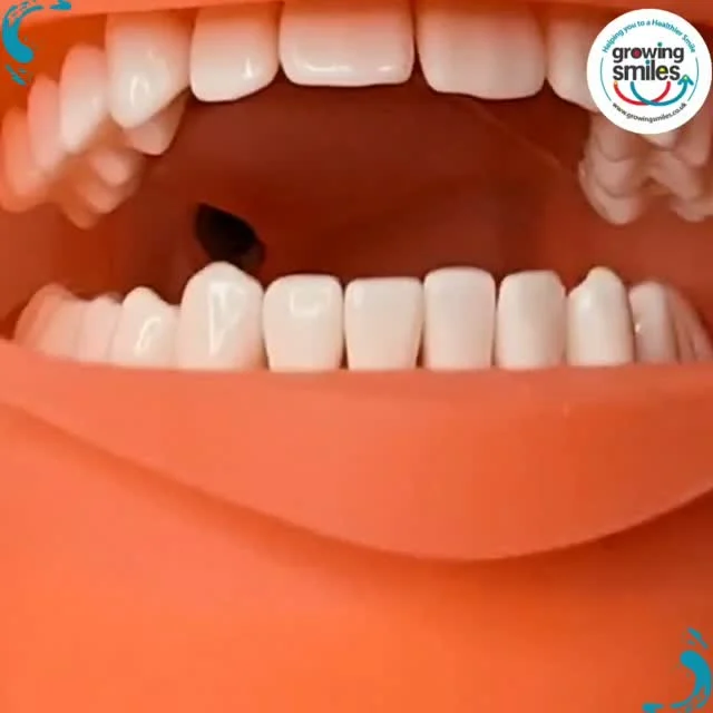 Talking Teeth Thursday 7pm live with oral health coach LeighGS on Facebook Growingsmilesuk What will we chat about tonight? Got a question? Let us know 👇DM or email info@growingsmiles.co.uk #mouthcarequestions #questionoftheday #myteeth #mymouth #lovethesmileyouhave