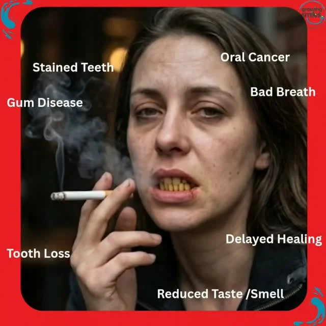 Smoking isn't good for your oral, overall health and wellbeing..... but quitting isn't easy. Today an updated Cochrane review reportedsmokers who want to quit have the best chance of doing so if they use nicotine e-cigarettes (vapes) over methods such as nicotine gums and patches and quitting with behavioural support or no support at all.Learn more about smoking and your smile at https://growingsmiles.co.uk/healthy-tips-for-happy-teeth-and-oral-health/smoking-tobacco-e-cigarettes-and-oral-health/